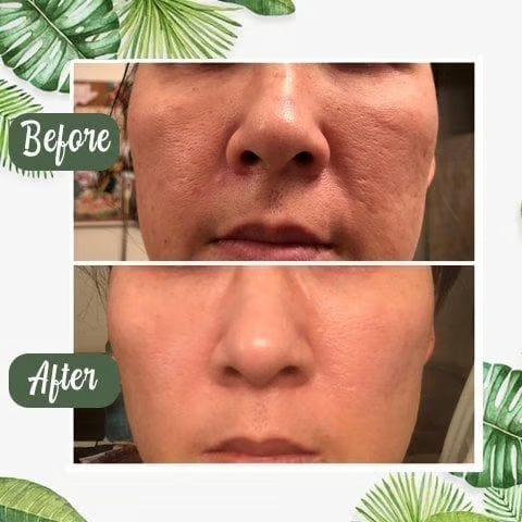 Eleroa ClearSkin Green Tea Stick – Visibly Clearer Skin in Just 7 Days